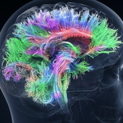 Image of brain activity